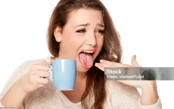 Lidah seperti Terbakar, Jangan Panik Ini Solusinya