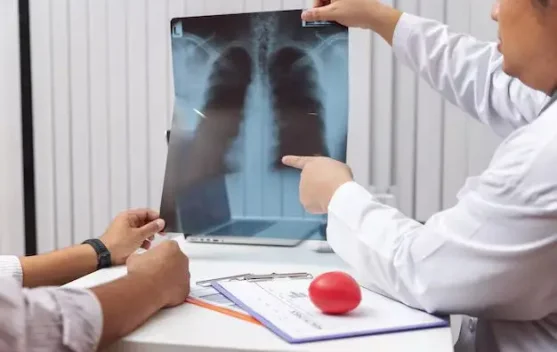 TBC di Nunukan Meningkat, Dinkes Temukan 545 Kasus  